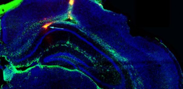 Green arrow points to the implant in the hippocampus of a mouse brain  