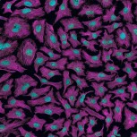 Cells from cervical cancer