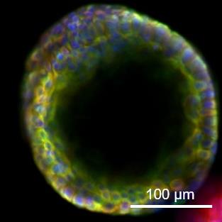 Biliary organoids grown on collagen tube exhibiting features of normal, healthy bile ducts.