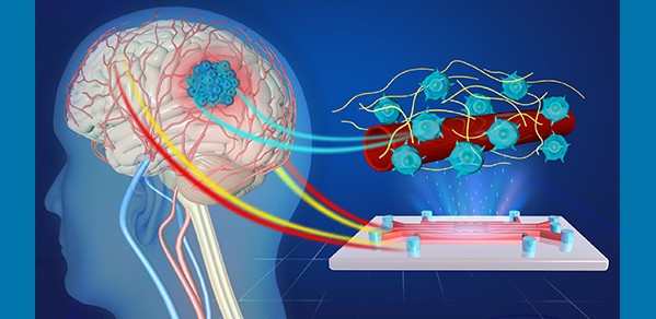 Artist's impression of the 3D microvessel-on-a-chip device for the study of glioblastoma.