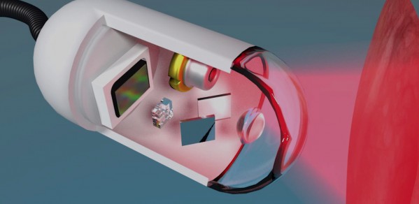 A ‘holographic capsule’ that a patient would swallow and that could detect the presence of and help distinguish between ‘plasias’ – types of tissue growth.