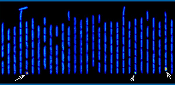 Antibiotic tolerant 'persister cells', seen here with the red signal level (high stress), are identified among normal cells (blue signal level - low stress)& tracked using a high-resolution microscope