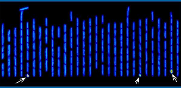 Antibiotic tolerant 'persister cells', seen here with the red signal level (high stress), are identified among normal cells (blue signal level - low stress)& tracked using a high-resolution microscope