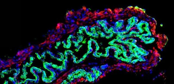 Image of a mouse gallbladder following repair with a bioengineered patch of tissue incorporating human 'bile duct' cells