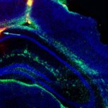 Green arrow points to the implant in the hippocampus of a mouse brain  Credit: Christopher Proctor