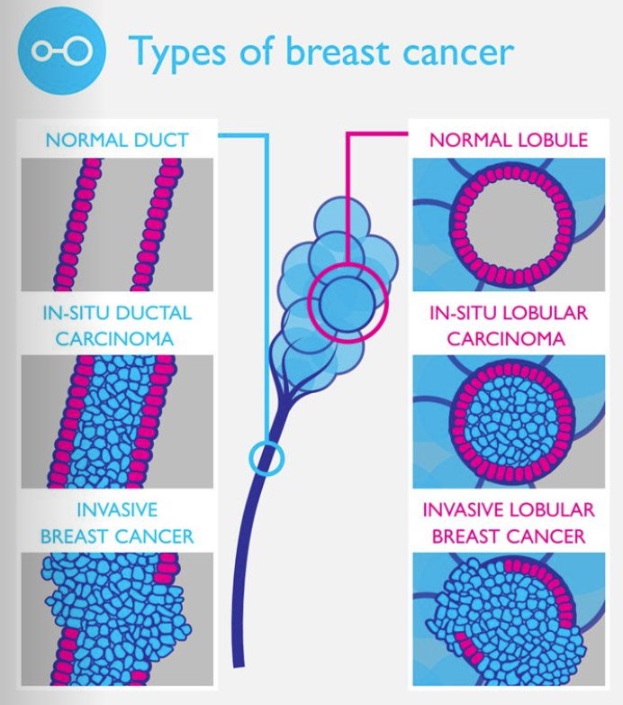 infographic