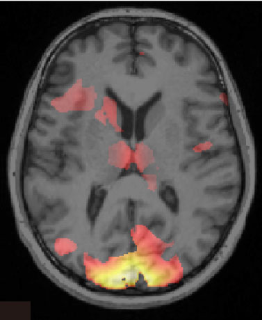 scan_of_brain_showing_information_associated_with_a_fear_memory