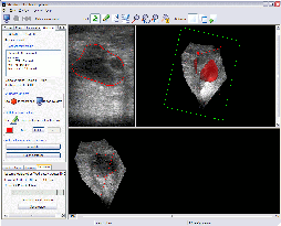 Stradwin user interface